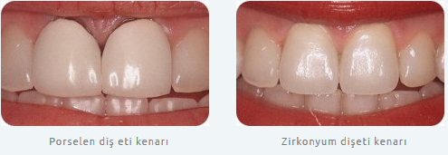 zirkonyum